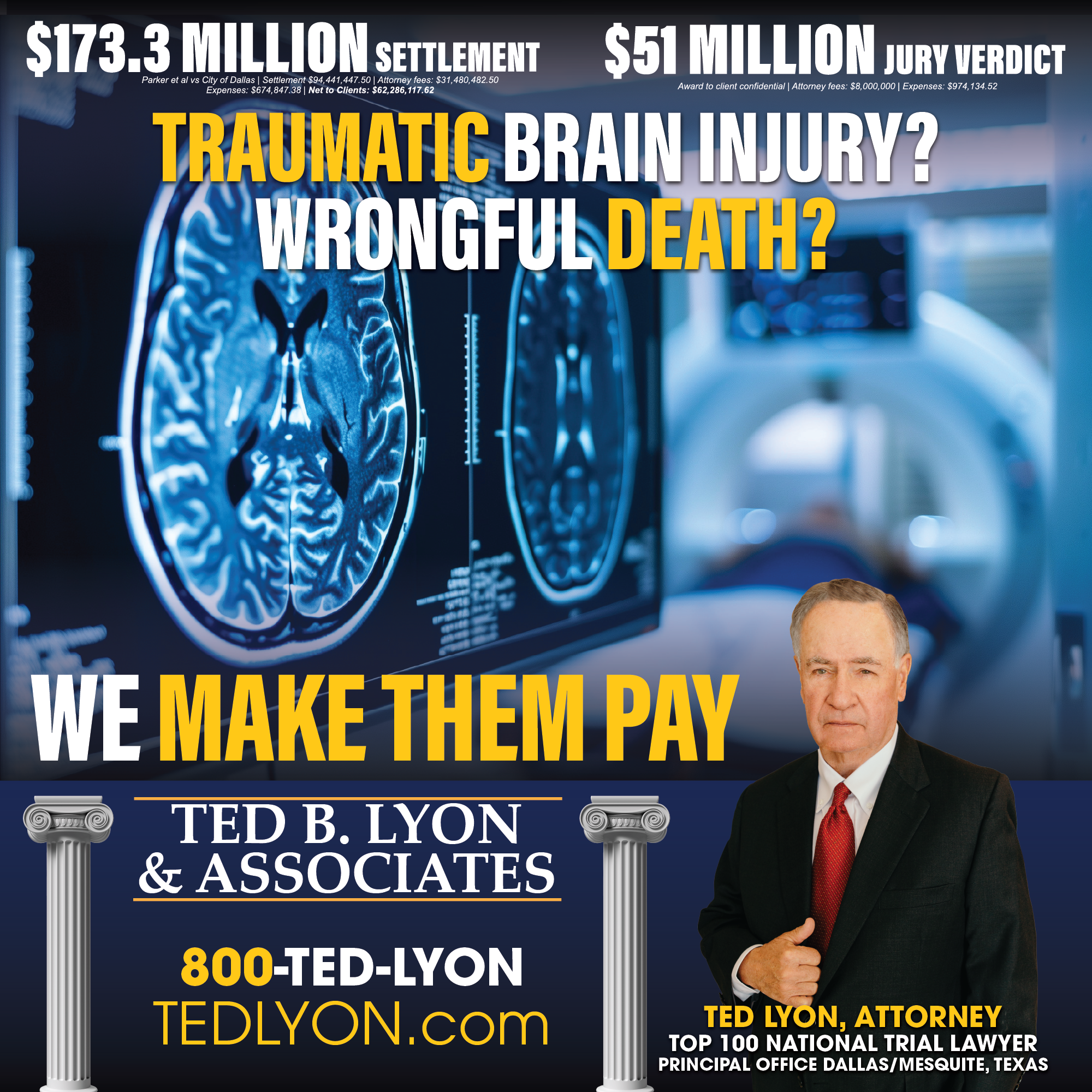 Traumatic Brain Injury Texas