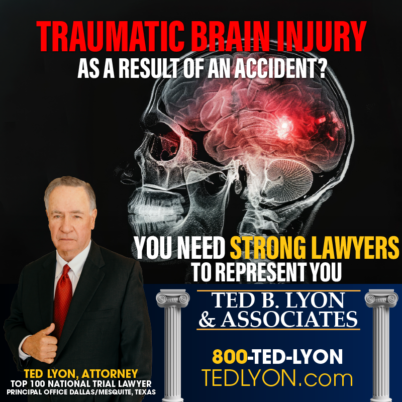traumatic brain injury dallas