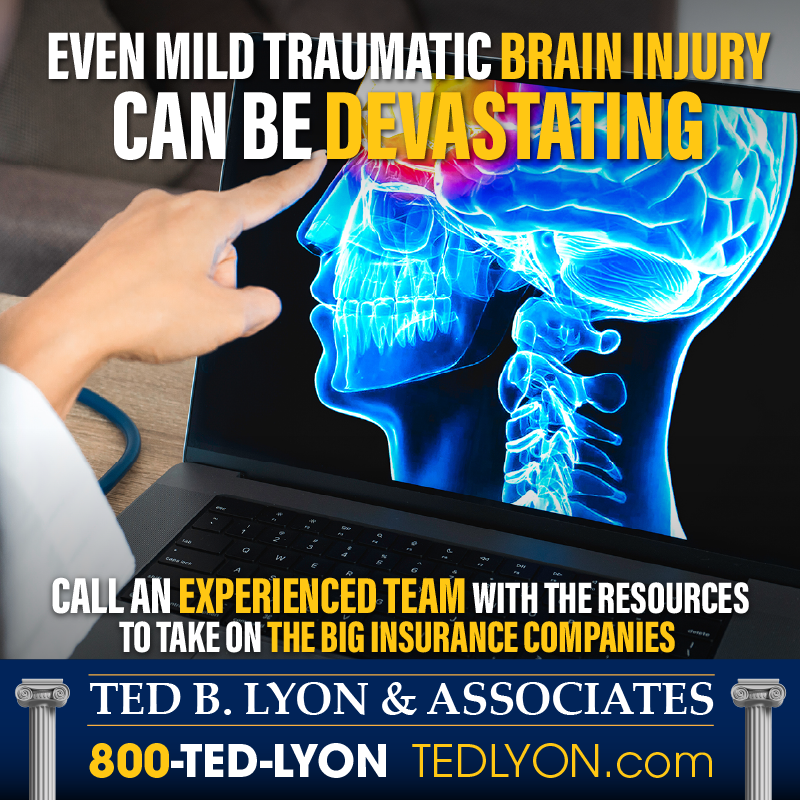 When Head Injuries Don't Show Symptoms Right Away